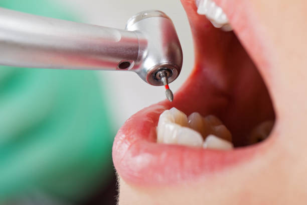 Best Broken Tooth Emergency  in Avila Beach, CA